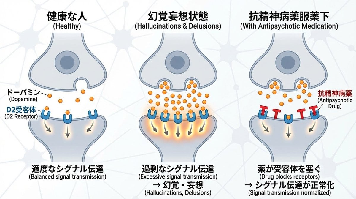 Dopamine and schizophrenia synapse diagram - AIプロンプト